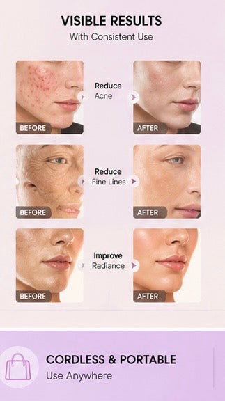 Veloura™ LED Light Therapy Face Mask | 7-Color Skin Rejuvenation